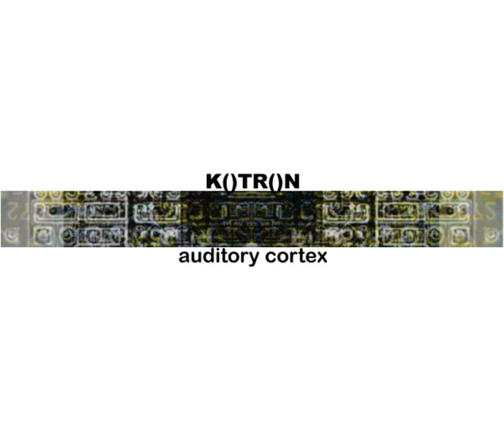 Kotron - auditory cortex - Mikael Madsen